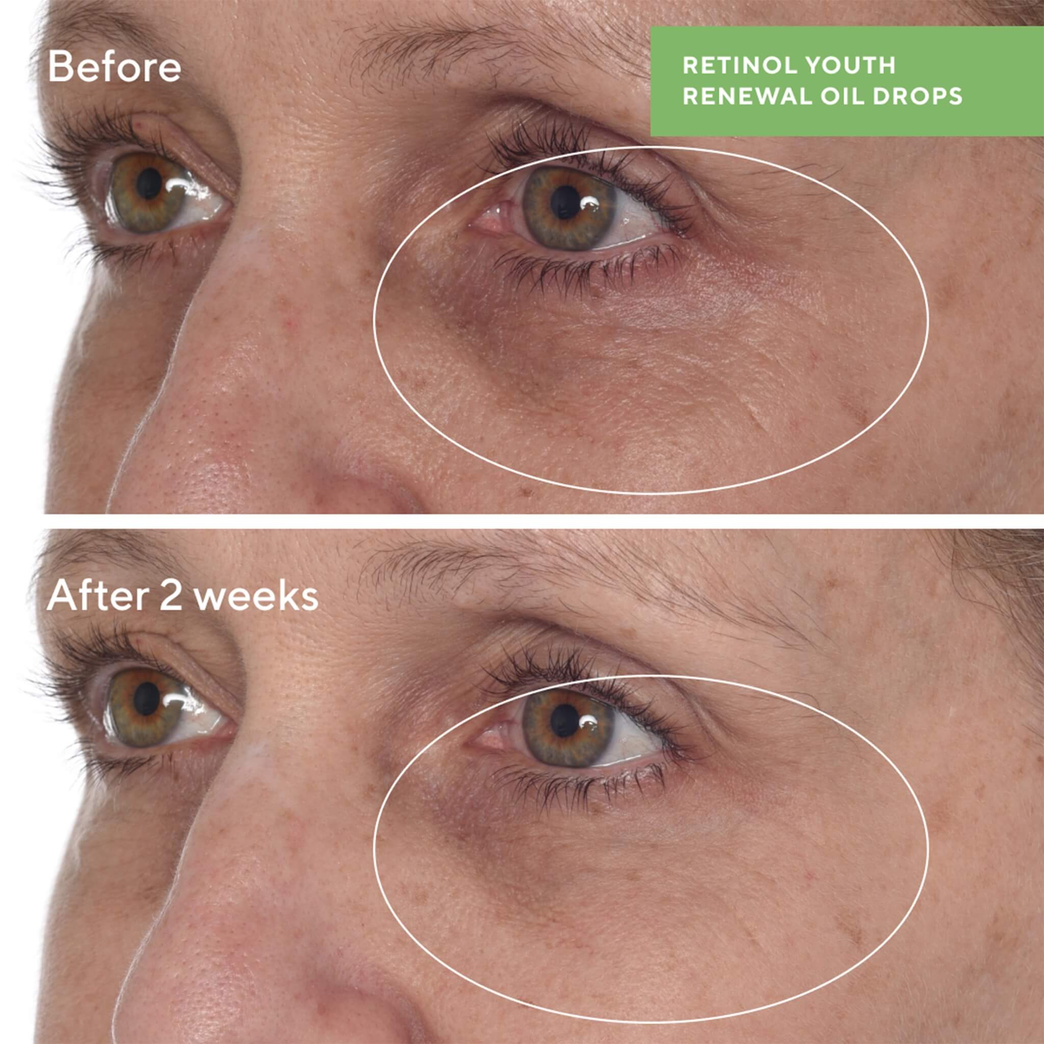 Retinol Youth Renewal Oil Drops, Resurgence, 30 ml.