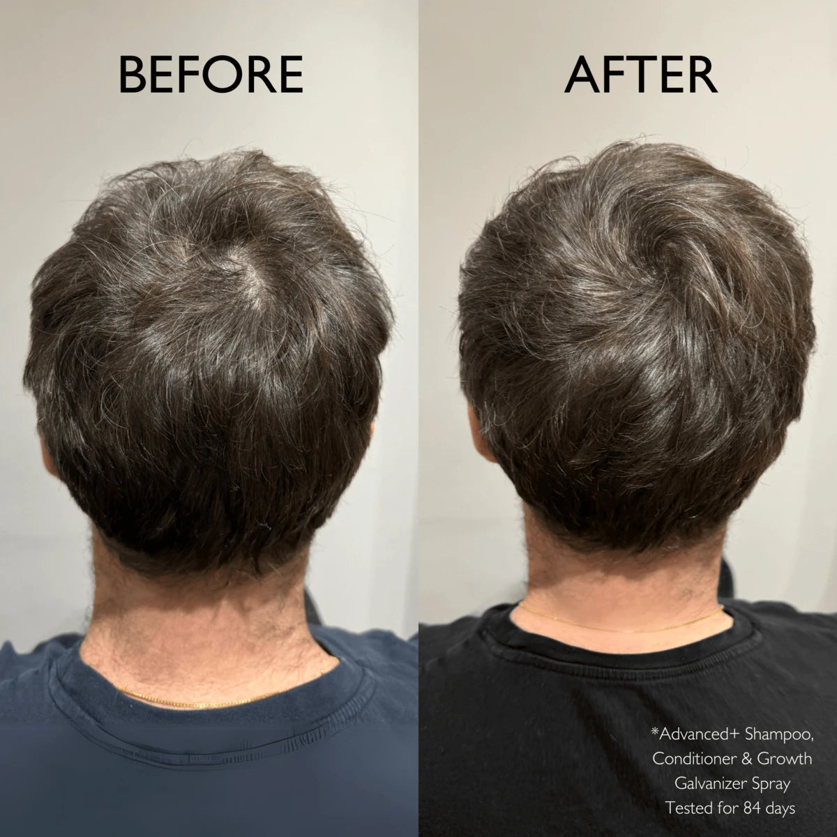Advanced+ Hair Growth Galvanizer, 100 ml.