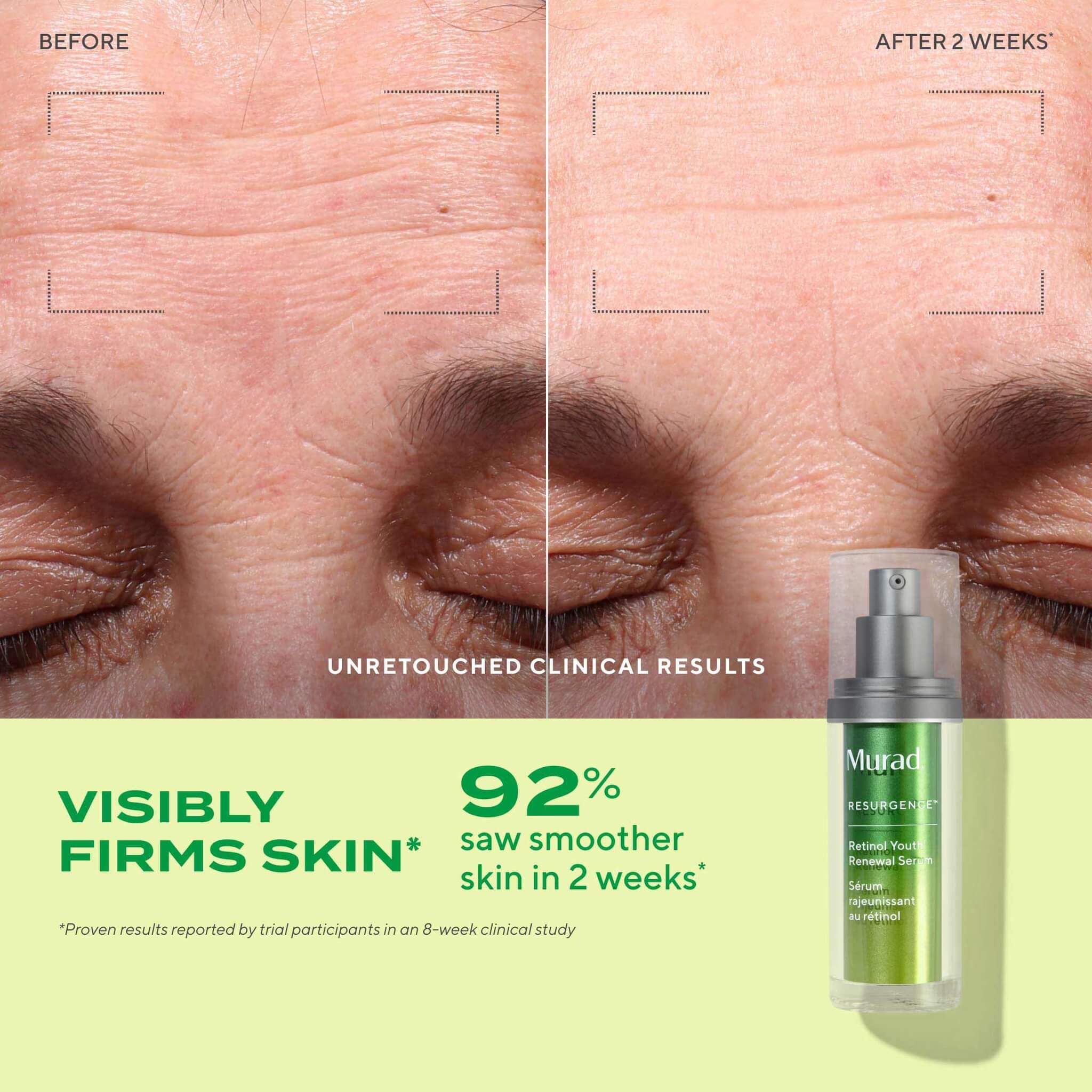 Retinol Youth Renewal Serum, Resurgence, 30 ml.