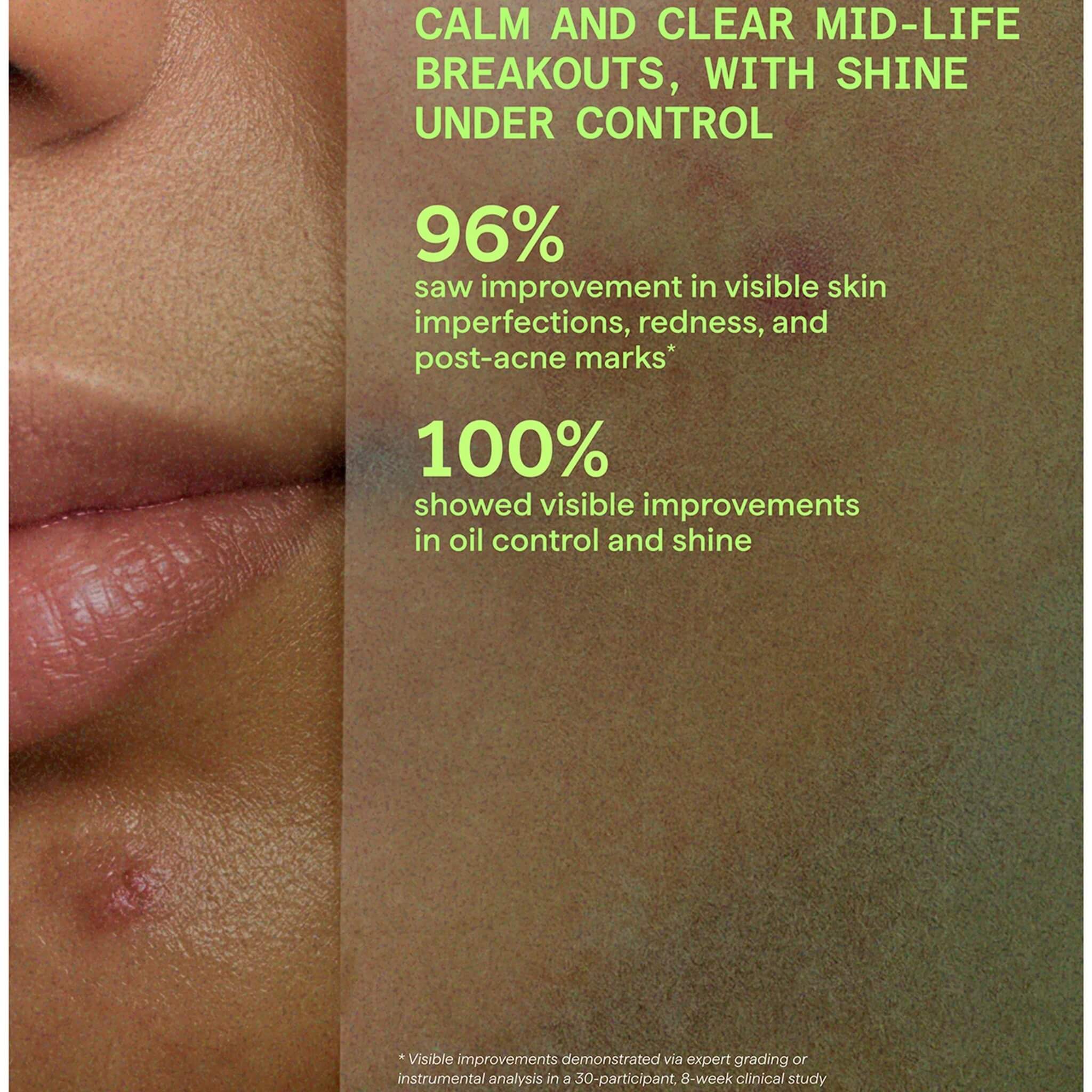 Biome-Balancing Calm + Recover Cream, Blemish Control, 50 ml.