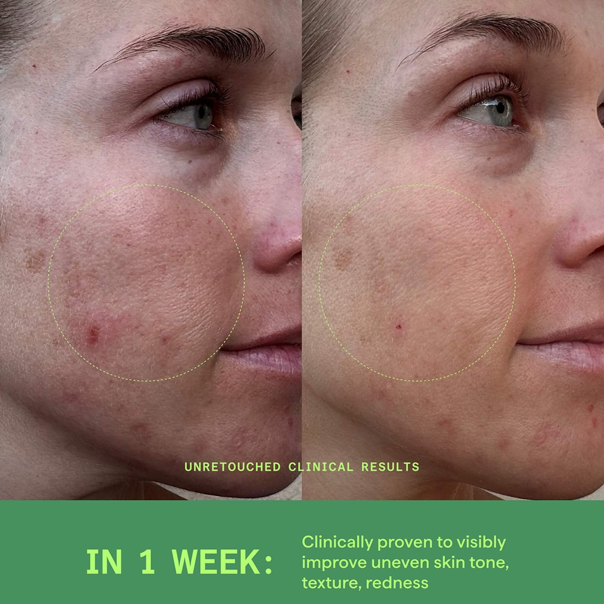 Biome-Balancing Calm + Recover Cream, Blemish Control, 50 ml.